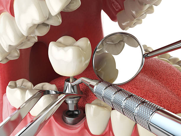 Best Emergency Dental Care for Broken or Chipped Teeth in Noble, OK