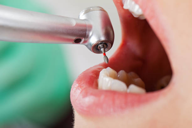 Best Emergency Gum Treatment in Noble, OK